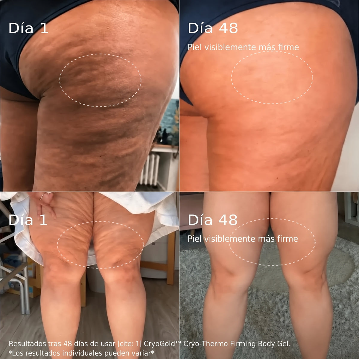 Borah™ - Gel Anti-Flacidez